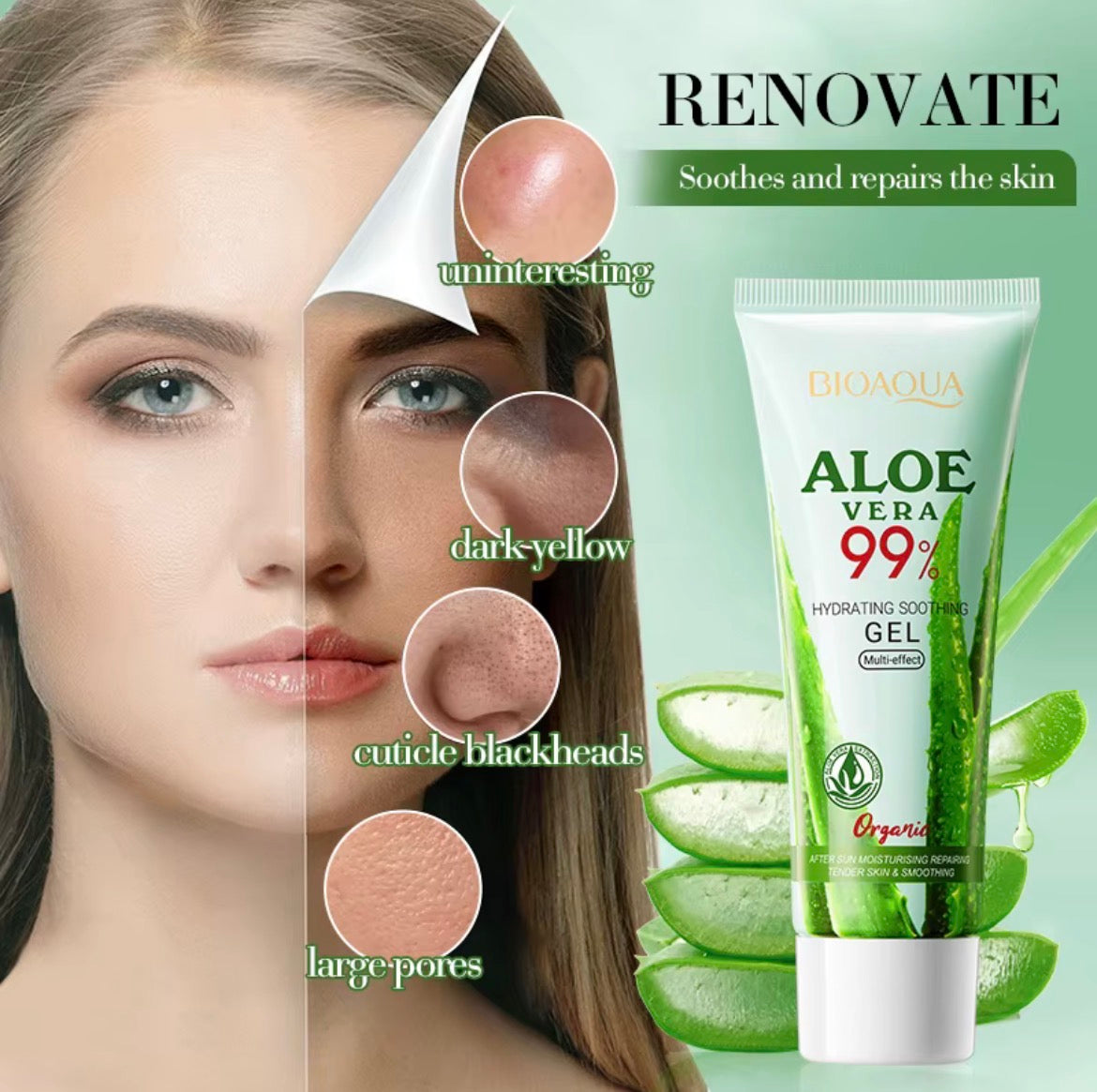 BIOAOUA Soothing Aloe Vera Gel for Face and Body Moisturizing Moisturizing Restorative Sunburn Relief Acne Care for Sensitive Skin