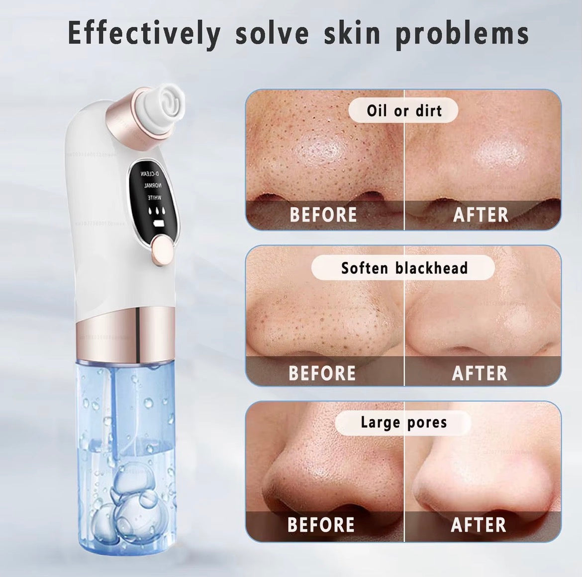 Comedon Printer Pore Vacuum Facial Cleanser Electric Pimple Acne Blackheads Remove USB Rechargeable Water Cycle Black Dot Remove