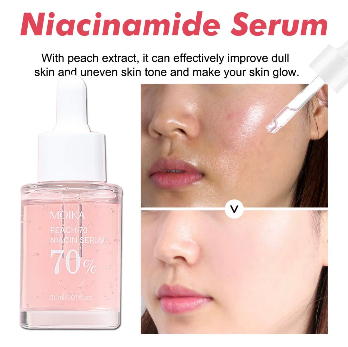 Niacinamide Serum Dark Spot Remover Fade Acne Marks Hyperpigmentation Shrink Pores Even Skin Color Moisturizing Korea Skin Care 3