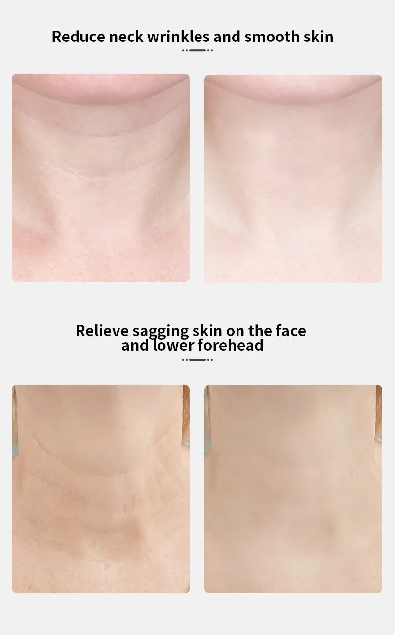 ANLAN Neck Face Beauty Device EMS Facial Neck Lifting 3 Colors Light Skincare Skin Tighten Reduce Double Chin Skin Care Tools