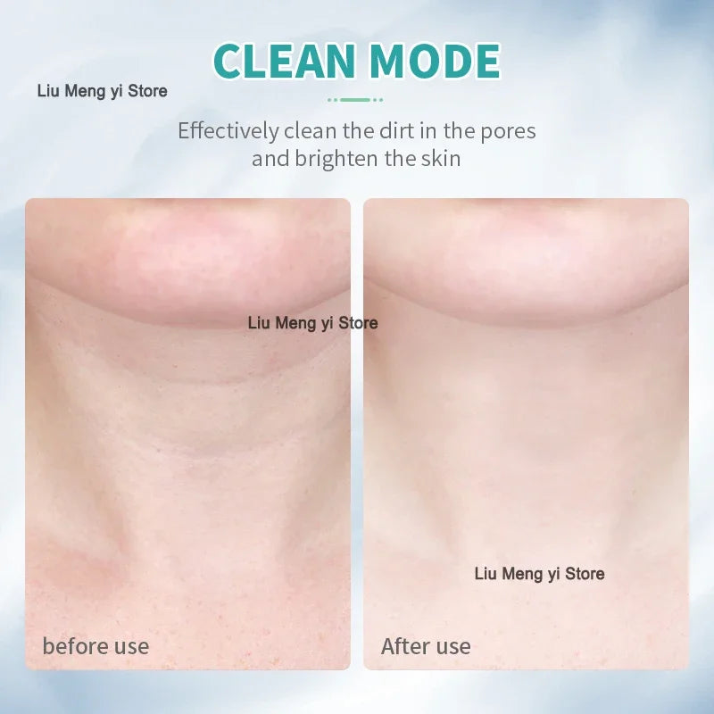 ANLAN Neck Face Beauty Device EMS Facial Neck Lifting 3 Colors Light Skincare Skin Tighten Reduce Double Chin Skin Care Tools